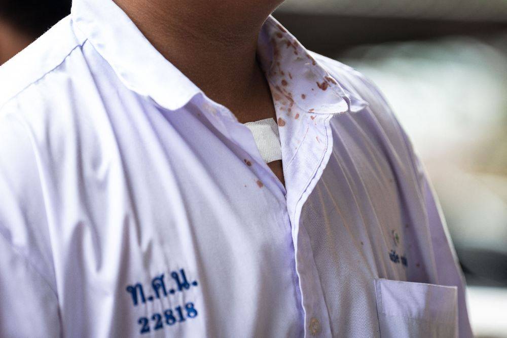 Blood stains are seen on a student's shirt collar following a school shooting in Bang Kruai district, Nonthaburi province, north of Thailand's capital Bangkok. Photo by AFP
