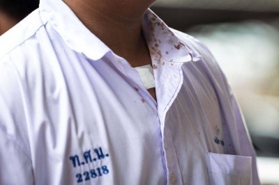 Blood stains are seen on a student's shirt collar following a school shooting in Bang Kruai district, Nonthaburi province, north of Thailand's capital Bangkok. Photo by AFP
