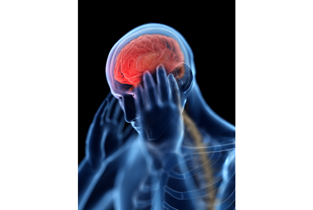 Strok merupakan penyakit ketiga tertinggi di Malaysia yang menyebabkan kematian.
