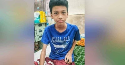 Keadaan Mohd Hidayat selepas kehilangan kaki kiri akibat penyakit kanser tulang.