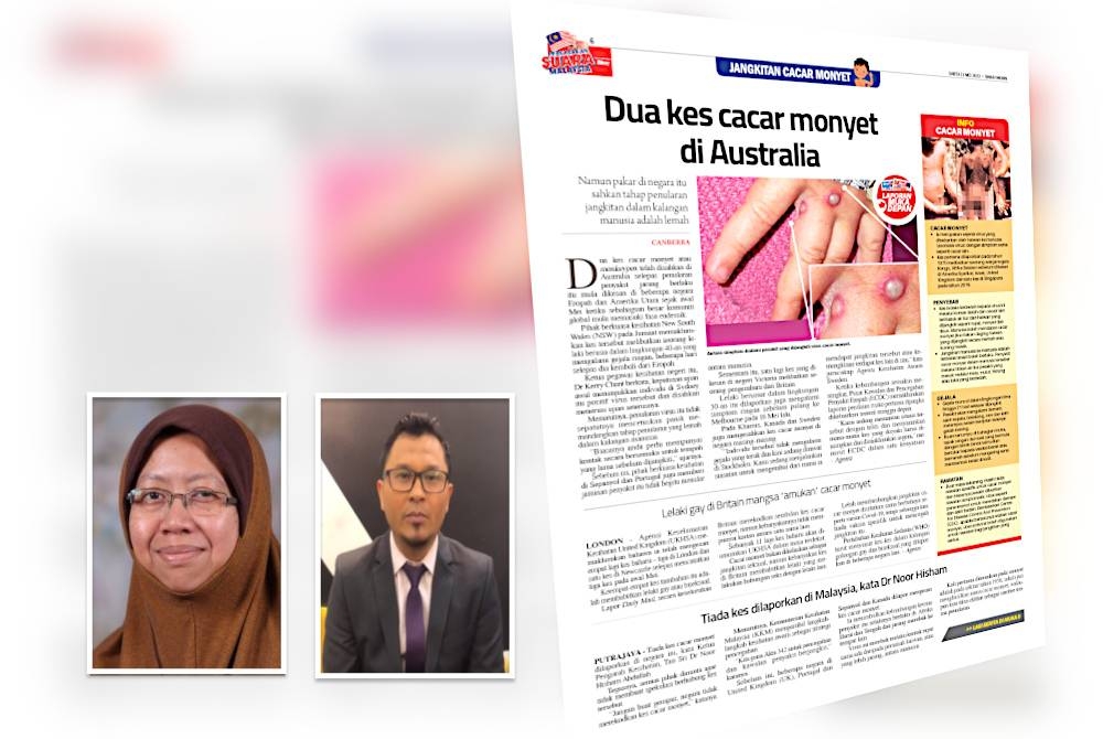 Laporan Sinar Harian pada Sabtu mengenai kes cacar monyet. Gambar kecil: Dr Malina, Dr Hanafiah 