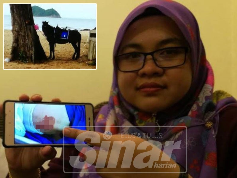 Nuraini menunjukkan kecederaan yang dialaminya ketika menunggang kuda.