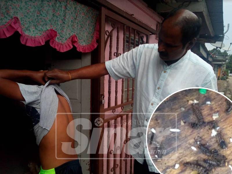 Manickam melihat badan seorang kanak kanak lelaki yang diserang ulat bulu.