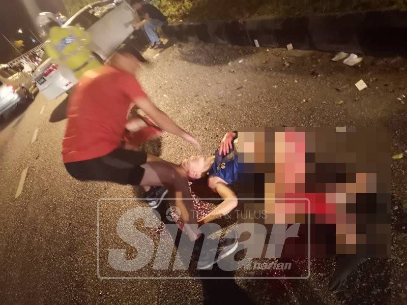 Peserta larian patah kedua-dua kakinya dalam kejadian awal pagi tadi.
