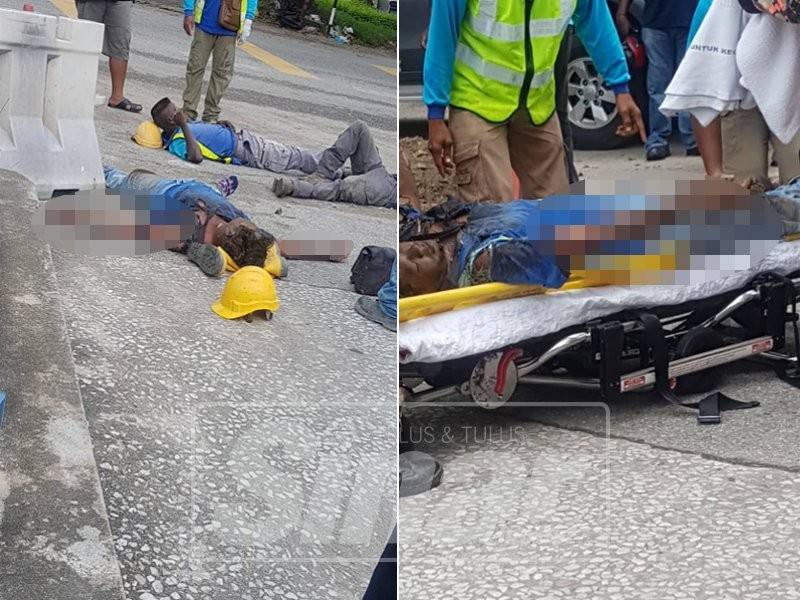 Keadaan mangsa yang melecur dalam kejadian pagi tadi.