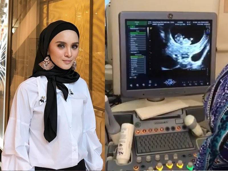 - Foto Instagram Hanez Suraya