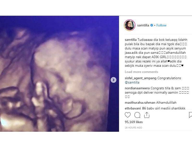 Foto Instagram Syatila Melvin