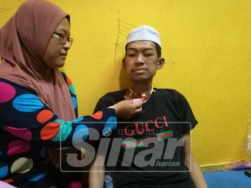 Abdul Halim turut berdepan masalah pernafasan sempit sekaligus memaksa lehernya ditebuk.
