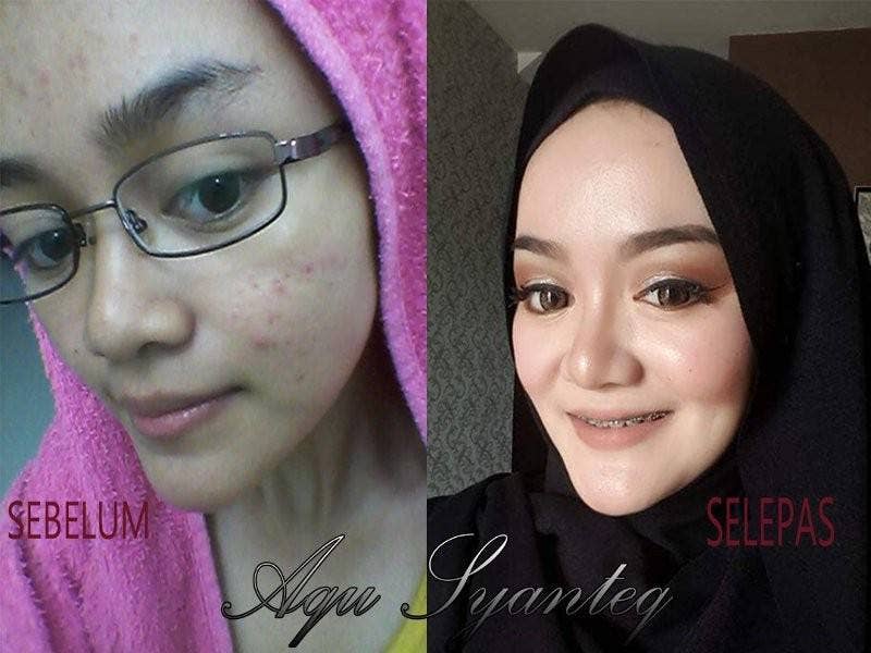 Perbezaan kulit wajah setelah menggunakan produk Aqu Syanteq. 