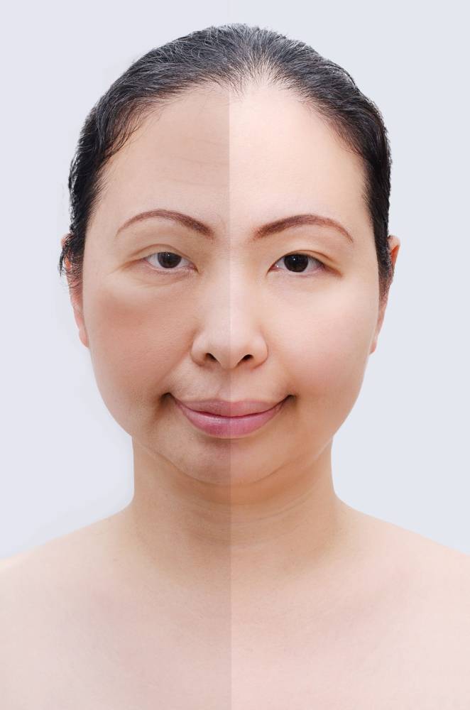 
Semua individu akan mengalami proses penuaan. 