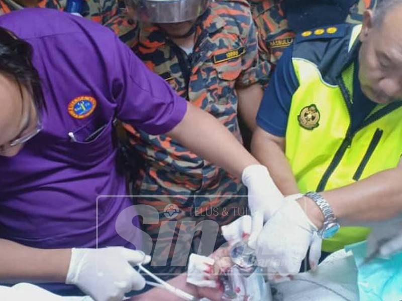 Kamarulzaman (kanan) bersama kakitangan Hospital Melaka mengeluarkan pergelangan tangan mangsa yang tersepit.