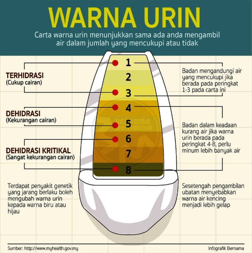 warna urin