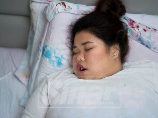 Obesiti antara faktor penyumbang masalah berdengkur ketika tidur. 