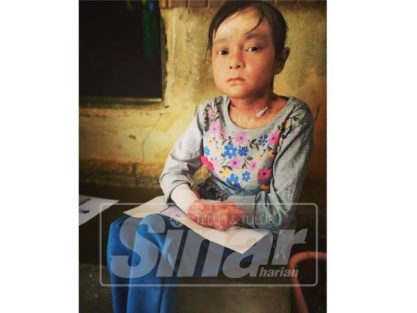  Nik Ainin Sofiya perlu menggunakan pembalut badan khas untuk keselesaan kulitnya.