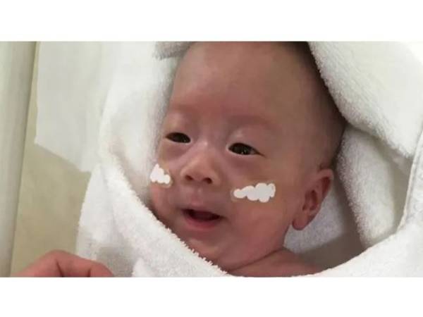 Keadaan terkini bayi tersebut selepas dirawat selama lima bulan.