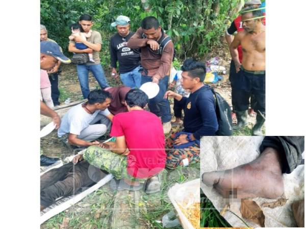 Mangsa ditemui pihak bomba dan penduduk (Gambar kecil: Kaki mangsa ditusuk ranting kayu)