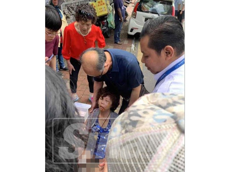 Chen Yue Zhen cedera selepas begnya diragut lelaki bermotosikal.