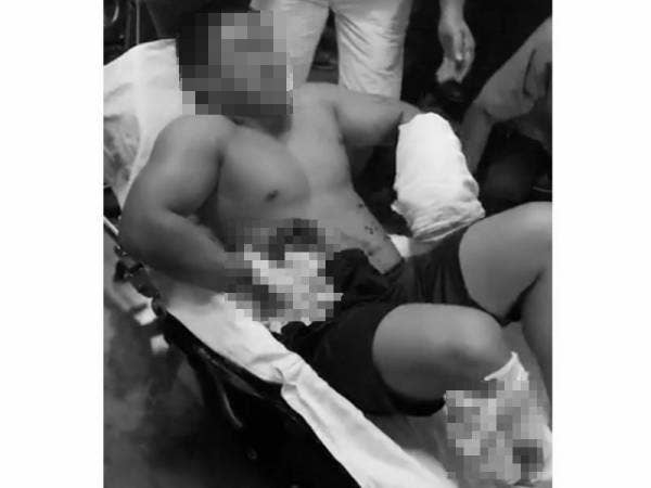 Mangsa mengalami kecederaan di bahagian perut, betis dan pergelangan tangan akibat diserang dengan parang dan rotan.
