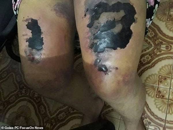 Mangsa berusia 31 tahun dikurung dan dipukul oleh suaminya yang kononnya menjalankan upacara menghalau roh jahat.
