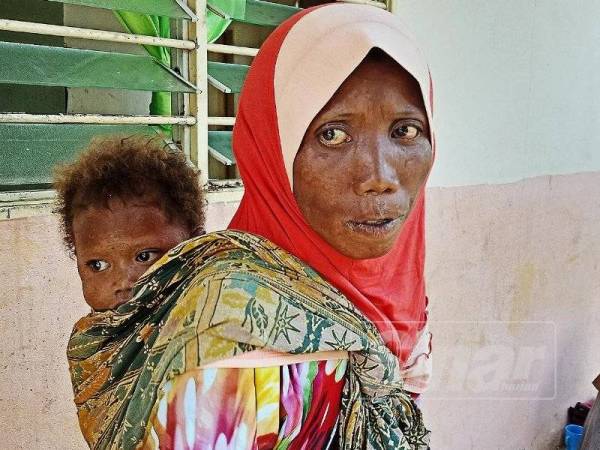 
Yati bersama anaknya, Sem, 2, yang turut berdepan masalah penyakit kulit kronik.