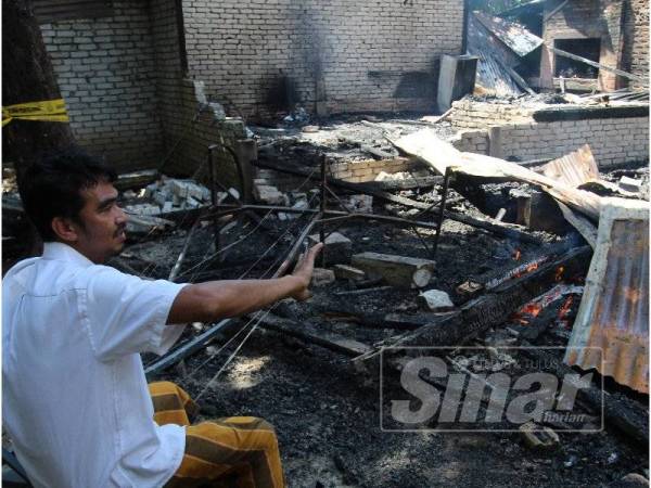 Juhar melecur di lenggan apabila cuba menyelamatkan dokumen ketika rumahnya terbakar di Lorong Haji Kadir, Kampung Bukit.