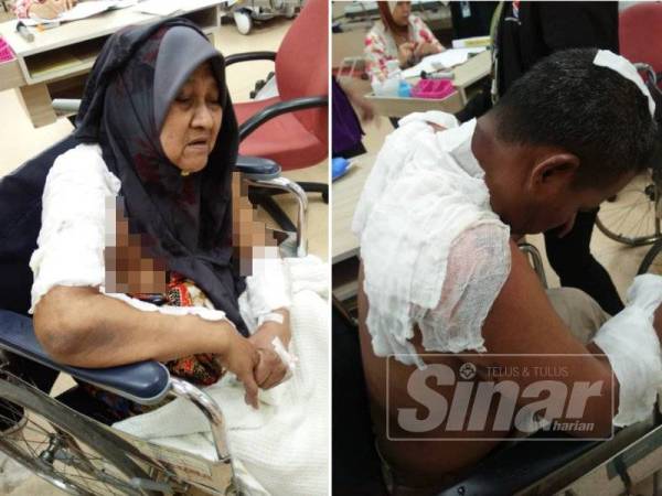 Zamri dan Hasnah melecur dalam kejadian kebakaran awal pagi tadi.