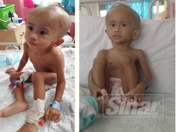 Akil mengidapi ketumbuhan di kepala yang boleh membesar dan akan mengganggu penglihatannya.(Tubuh badan Akil juga tidak membesar seperti kanak-kanak normal.)