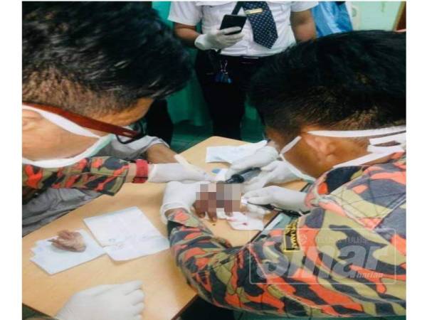 Operasi memotong jari pada jari mangsa. - Foto JBPM KL