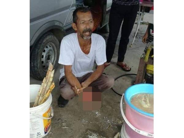 Osman menahan kesakitan selepas jarinya hancur seperti hampas tebu.