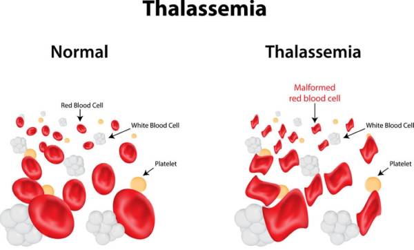 Dilema pesakit talasemia