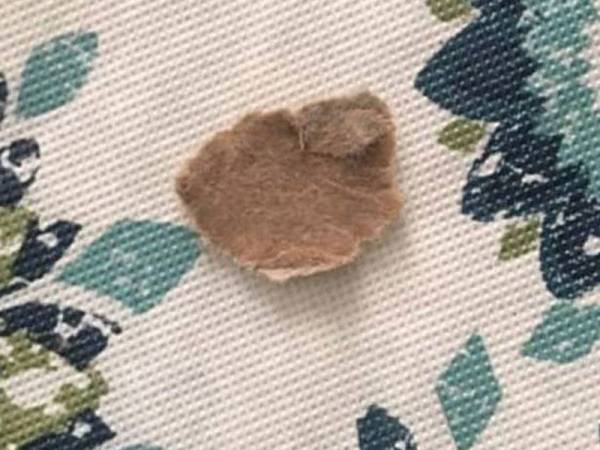 Cebisan kotak yang terlekat di lelangit mulut Bella.