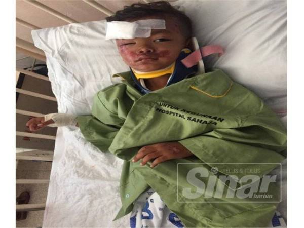 Ahmad Raiyan terpaksa menjalani pembedahan kecil di dahi kanan selepas terjatuh daripada motosikal ditunggang abang sepupunya dalam kejadian di Jalan Sungai Sireh, petang semalam.