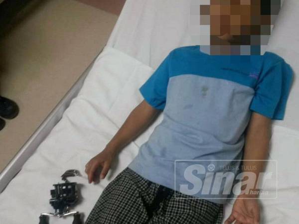 Keadaan mangsa selepas mesin pancing itu berjaya dikeluarkan daripada jari kanak-kanak terbabit.