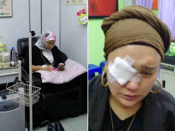 Keadaan Azharina yang mengalami sakit mata.