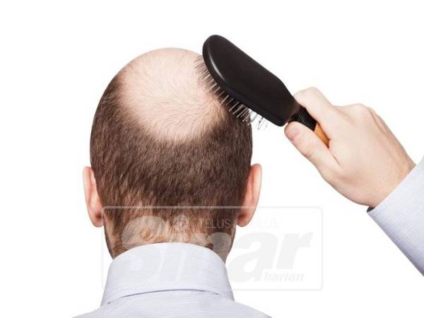 MASALAH rambut gugur boleh menjejaskan penampilan menganggu emosi seseorang.