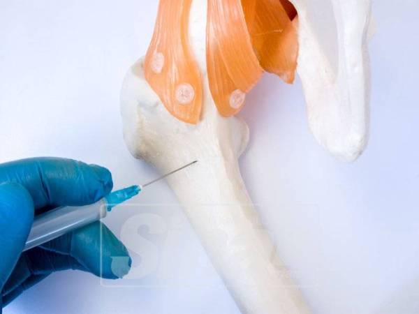 SEORANG pakar mengesahkan bahawa susu yang tinggi dengan zat kalsium dan protein diperlukan oleh seorang pesakit kanser.