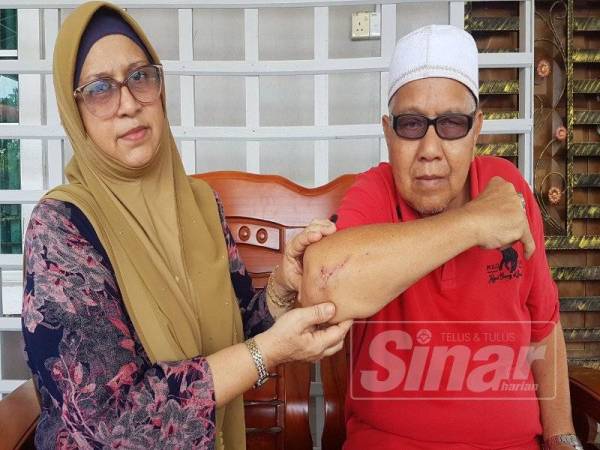Zarina menunjukkan kecederaan pada siku kanan suaminya, Abdul Fatah selepas insiden terjatuh dibatas jalan ketika cuba melarikan diri dari pak belang semalam.