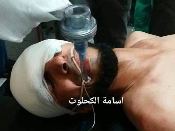 Krew Al-Aqsa TV, Sami Mosran mengalami kecederaan serius selepas peluru getah Israel terkena bahagian matanya.