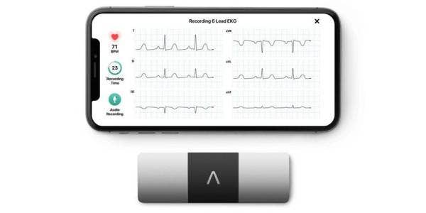PERANTI KardiaMobile menggunakan teknologi artificial intelligence (Ai) menjadi monitor kawalan elektrokardiogram standard EKG atau ECG peribadi kepada pengguna.