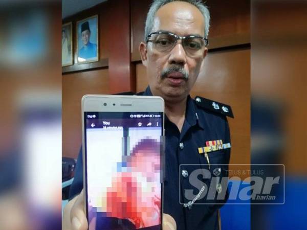 Aidi Sham menunjukkan keadaan lengan suspek yang ditorehnya.