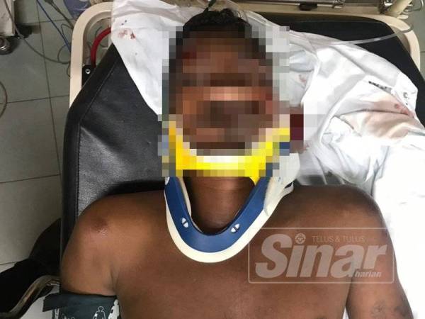 Suspek yang cedera dirawat di Hospital Bukit Mertajam dan akan direman tujuh hari untuk siasatan.