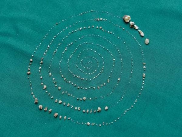 Struktur seperti gigi itu terdapat dalam pelbagai saiz.