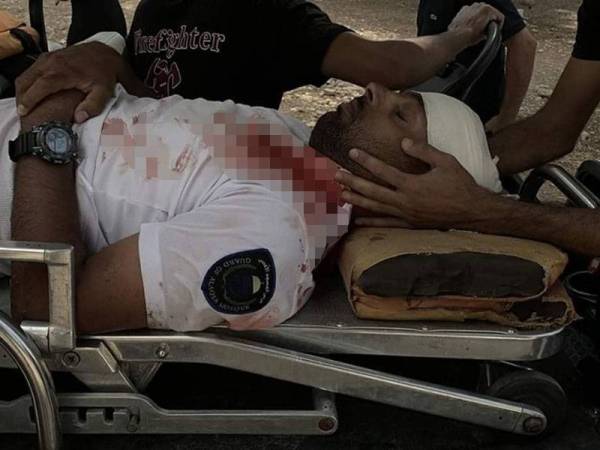 Muhannad Idris mengalami kecederaan parah selepas dibelasah polis Israel dalam kejadian Sabtu lalu.