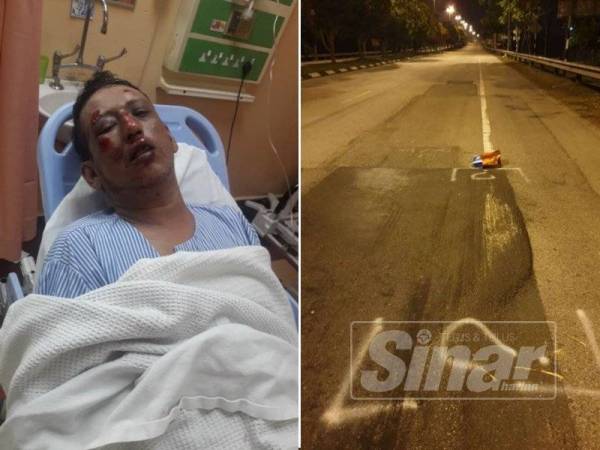 Akibat kemalangan 3 Ogos lalu, Aziz mengalami kecederaan di bahagian kaki kiri dan kanan, patah tulang pipi, lidah terkoyak selain luka di tangan serta muka.