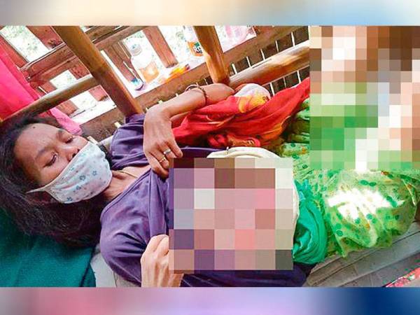 Penyakit barah yang dideritai Christina Ombao bertambah buruk akibat tidak mampu mendapatkan rawatan di hospital. Foto: Agensi