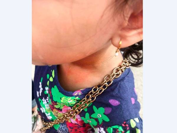 Leher anaknya merah selepas rantai dipakainya diragut.