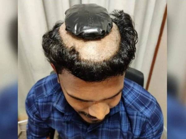 Seorang lelaki ditahan di Lapangan Terbang Kochi, India semalam apabila cuba menyeludup lebih 1kg emas di bawah rambut palsunya. - Foto India Today