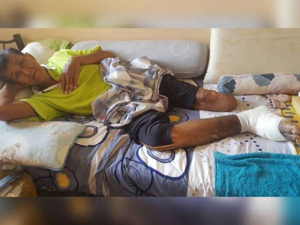 Keadaan terkini Mohd Salihin yang kini turut menghadapi jangkitan kuman di bahagian kaki kanannya.