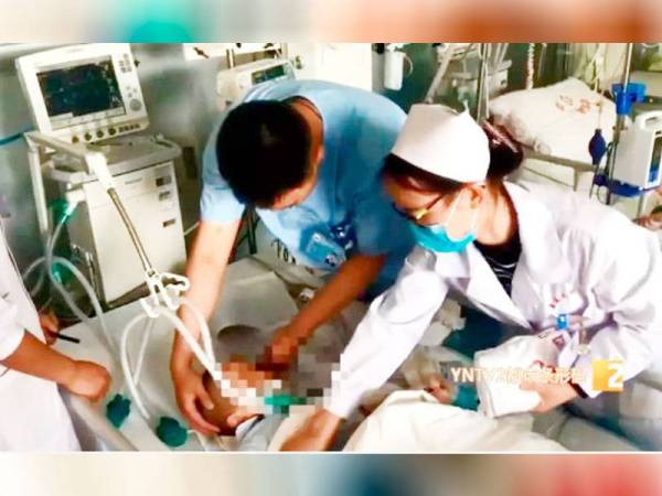 Kanak-kanak tersebut kini di bawah pemantauan doktor.