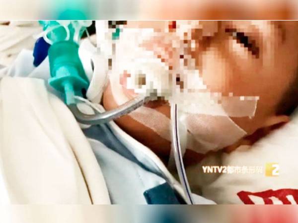 Pembedahan terbabit yang memakan masa tiga jam berjaya dilakukan dan kini kanak-kanak tersebut berada di bawah pemantauan pihak hospital.